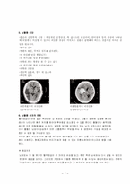[의료사회사업론] 뇌졸중-7