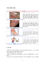 여름철 레저 스포츠 여름 레저 활동을 즐기자!-5