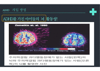 주의력결핍과잉행동장애 PPT(ADHD, 장애극복사례, 마이클펠프스, ADHD극복사례, 내소감) 프레젠테이션-18