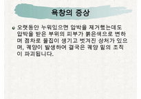 욕창간호, 욕창이란, 욕창의원인, 욕창의증상, 욕창의 위험요인, 욕창의 발생부위, 욕창관리, 욕창상처간호-5