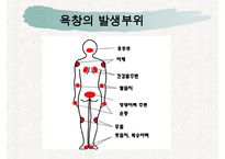 욕창간호, 욕창이란, 욕창의원인, 욕창의증상, 욕창의 위험요인, 욕창의 발생부위, 욕창관리, 욕창상처간호-7