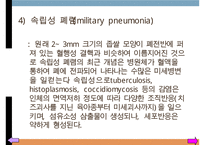 폐렴, 폐렴정의, 폐렴분류, 폐렴병태생리, 폐렴빈도, 폐렴위험요인, 폐렴증상, 폐렴치료, 폐렴합병증, 폐렴예후, 폐렴 케이스스터디-8