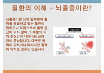 뇌졸중, 뇌졸중이란, 뇌졸중종류, 뇌졸중합병증, 뇌졸중후유증, 뇌졸중예후, 재활치료, 사회복지사의개입, 뇌졸중에 대한 사례,-2
