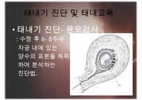 [태내기] 태내 환경 및 태내기 진단(유전상담, 초음파, 융모, 양수검사등), 태내기 교육(전통, 현대적), 태내기에 대한 견해PPT자료 수정 다운 홍보-16