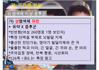 [특수교육] 정신지체의 생물학적 원인, 정신지체의 다양한 원인, 질병등 수정 다운 홍보-7