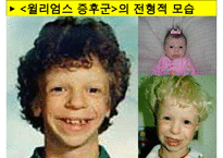[특수교육] 정신지체의 생물학적 원인, 정신지체의 다양한 원인, 질병등 수정 다운 홍보-20