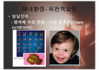 [태내기] 태내 환경, 태내기 진단(유전상담, 초음파, 융모, 양수검사등), 태내기 교육(전통, 현대적), 태내기에 대한 견해 수정 다운 홍보-5