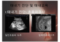 [태내기] 태내 환경, 태내기 진단(유전상담, 초음파, 융모, 양수검사등), 태내기 교육(전통, 현대적), 태내기에 대한 견해 수정 다운 홍보-15
