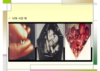 낙태 문제의 해결책 피임방법] 낙태의 개념과 증가 원인 및 낙태의 문제점과 대책방안으로서의 피임에 대하여 수정 다운 홍보-6
