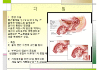낙태 문제의 해결책 피임방법] 낙태의 개념과 증가 원인 및 낙태의 문제점과 대책방안으로서의 피임에 대하여 수정 다운 홍보-16