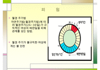 낙태 문제의 해결책 피임방법] 낙태의 개념과 증가 원인 및 낙태의 문제점과 대책방안으로서의 피임에 대하여 수정 다운 홍보-20