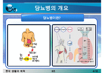 [당뇨병 치료방안] 당뇨병의 증상, 당뇨병 원인, 당뇨병의 치료방안(한의학, 양학, 운동치료법, 민간요법 등등 분석)-4