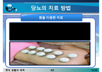[당뇨병 치료방안] 당뇨병의 증상, 당뇨병 원인, 당뇨병의 치료방안(한의학, 양학, 운동치료법, 민간요법 등등 분석)-15