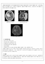[의료사회사업] 신경외과 수술거부환자에 대한 사례-5