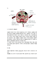 [신경계 질환] 신경계 질환의 종류(유형)와 치료방법 - 뇌졸중(뇌출혈,뇌경색), 간질, 치매, 편두통, 중증근무력증의 원인과 증상 및 치료 식이요법(식사요법)-4