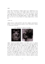 [뇌졸중] 뇌졸중의 유형(종류)과 원인 및 증상, 뇌졸중 예방 및 치료방법(뇌졸중의 영양치료, 약물치료, 수술치료)-2