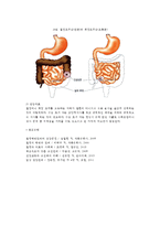 [염증성장질환] 만성염증성장질환(만성궤양성대장염, 크론병)의 원인과 증상 및 치료방법 - 영양치료, 약물치료, 수술치료(결장조루술, 회장조루술)-5