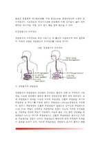 [환자의 영양지원] 경장영양 - 경장영양액의 종류, 경관급식의 투여경로 및 주입방법, 경관급식의 주의점과 합병증-4