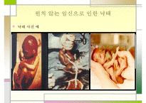 유아의 안전사고 특징 및 가정안전사고의 현황, 심각성, 아동의 안전사고 대책방안 수정 다운 홍보 3,000원 거래중지 169 7-5