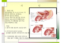 유아의 안전사고 특징 및 가정안전사고의 현황, 심각성, 아동의 안전사고 대책방안 수정 다운 홍보 3,000원 거래중지 169 7-16