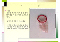 유아의 안전사고 특징 및 가정안전사고의 현황, 심각성, 아동의 안전사고 대책방안 수정 다운 홍보 3,000원 거래중지 169 7-17