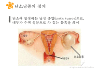 여성실습 난소낭종 케이스 PPT 발표자료-3