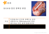 여성실습 난소낭종 케이스 PPT 발표자료-16