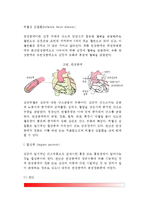 [허혈성 심질환] 협심증 및 심근경색의 원인과 증상 및 치료방법(식사요법-식이요법, 약물요법, 수술요법), 허혈성 심질환의 예방방법-3