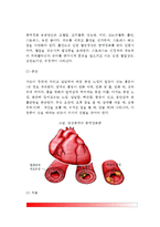 [허혈성 심질환] 협심증 및 심근경색의 원인과 증상 및 치료방법(식사요법-식이요법, 약물요법, 수술요법), 허혈성 심질환의 예방방법-4