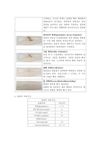 근골격계 간호 레포트-8