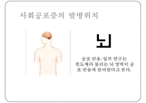 [사회 공포증(social phobia)] 사회 공포증 개념, 사회 공포증 종류, 사회 공포증 현황, 사회 공포증 원인, 사회 공포증 치료방법, 음악치료 적용pptx-7