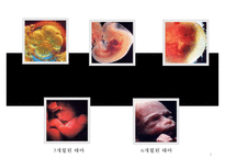[낙태의 심각성과 해결책] 낙태의 실태와 찬반 논쟁 및 낙태 해결방안-3