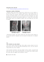 [골다공증, 골조송증] 골다공증(osteoporosis) 개념, 골조송증의 원인, 골다공증 진단, 골다공증 검사, 골다공증 치료, 골다공증 식이요법-11