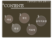 [정신분열증의 음악치료] 정신분열증 원인, 정신분열증 증상, 정신분열증 음악치료 방법-2