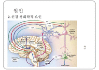 [정신분열증의 음악치료] 정신분열증 원인, 정신분열증 증상, 정신분열증 음악치료 방법-9