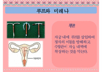 [피임] 피임, 피임 필요성, 피임 종류, 피임 도구, 피임 종류, 피임 성공률, 피임약 오남용 문제점, 피임 방법-9