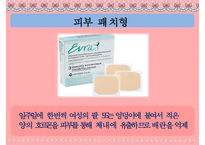 [피임] 피임, 피임 필요성, 피임 종류, 피임 도구, 피임 종류, 피임 성공률, 피임약 오남용 문제점, 피임 방법-14
