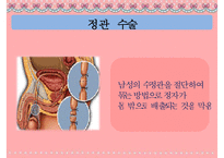 [피임] 피임, 피임 필요성, 피임 종류, 피임 도구, 피임 종류, 피임 성공률, 피임약 오남용 문제점, 피임 방법-17