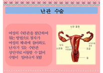 [피임] 피임, 피임 필요성, 피임 종류, 피임 도구, 피임 종류, 피임 성공률, 피임약 오남용 문제점, 피임 방법-18