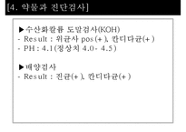 칸디다성 질염 간호과정-16