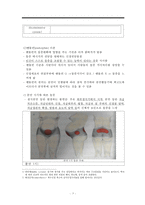 통증, 통증정의, 통증발생기전, 분만통증, 분만통증완화법, 무통요법, 척추마취, 분만통증간호, 척추마취간호-5