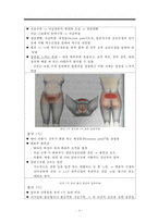 통증, 통증정의, 통증발생기전, 분만통증, 분만통증완화법, 무통요법, 척추마취, 분만통증간호, 척추마취간호-6