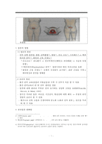 통증, 통증정의, 통증발생기전, 분만통증, 분만통증완화법, 무통요법, 척추마취, 분만통증간호, 척추마취간호-7