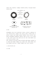 [동맥경화증] 동맥경화증의 원인(요인)과 증상, 동맥경화증의 정의와 종류(분류), 동맥경화 치료방법(식이요법)-4