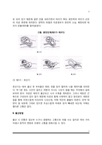 출산의 단계와 출산방법(분만법), 출산관련 문제-3