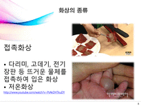 [의료사회복지] 화상에 대한 이해-8