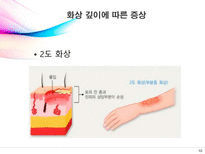 [의료사회복지] 화상에 대한 이해-10