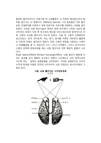 대뇌반구의 기능 편재화-3