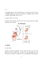 [신장질환 식이요법] 신장질환(신증후군, 급성신부전 및 만성신부전, 혈액투석, 지속성 복막투석, 신결석증)의 원인과 증상 및 치료를 위한 식사요법-14