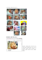 아동학대 관련 기사를 10편 이상 조사한 후, 현재 아동학대의 실태-12